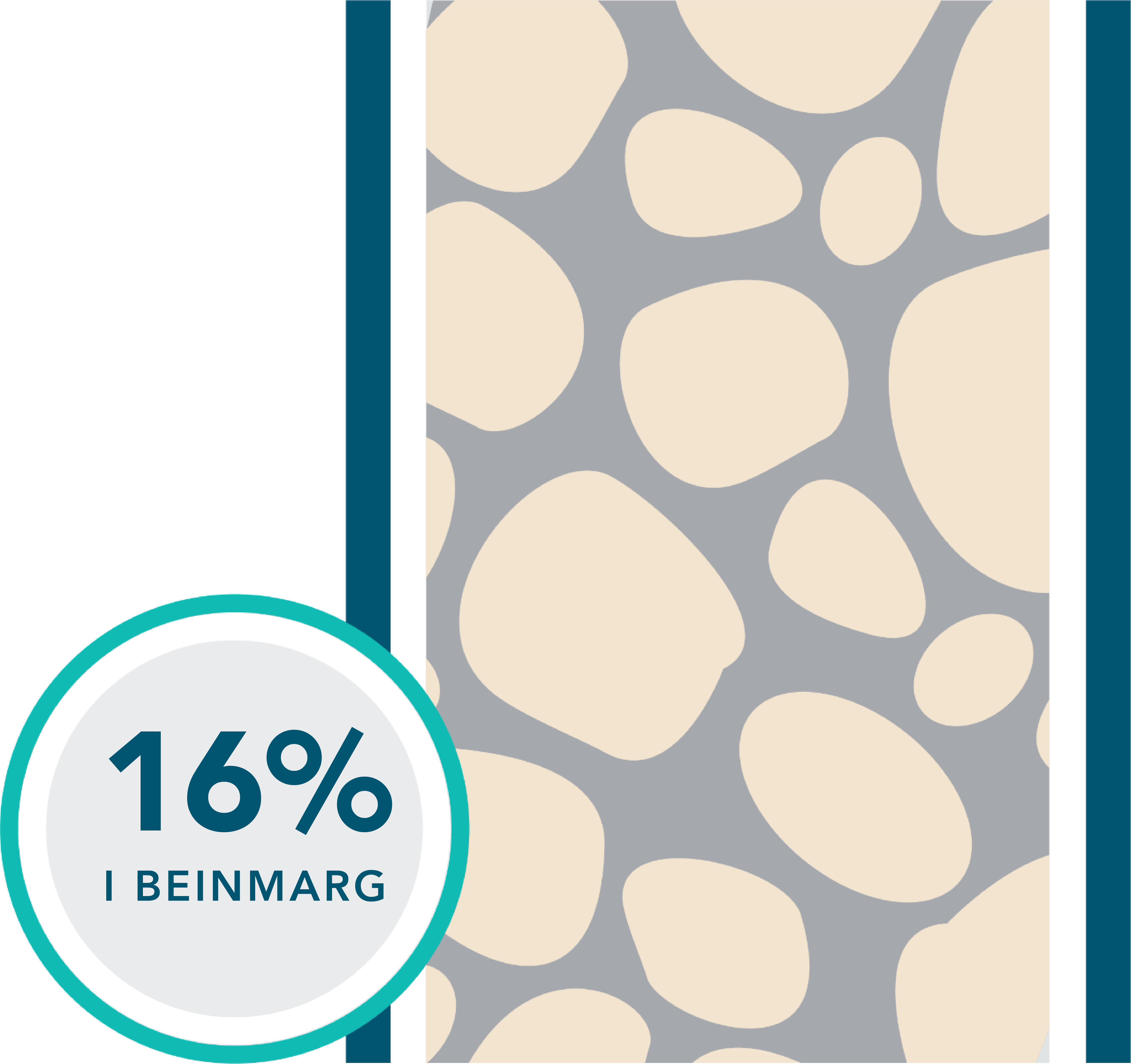 Previously-treated VEN+R patients: 16% undetectable MRD in bone marrow